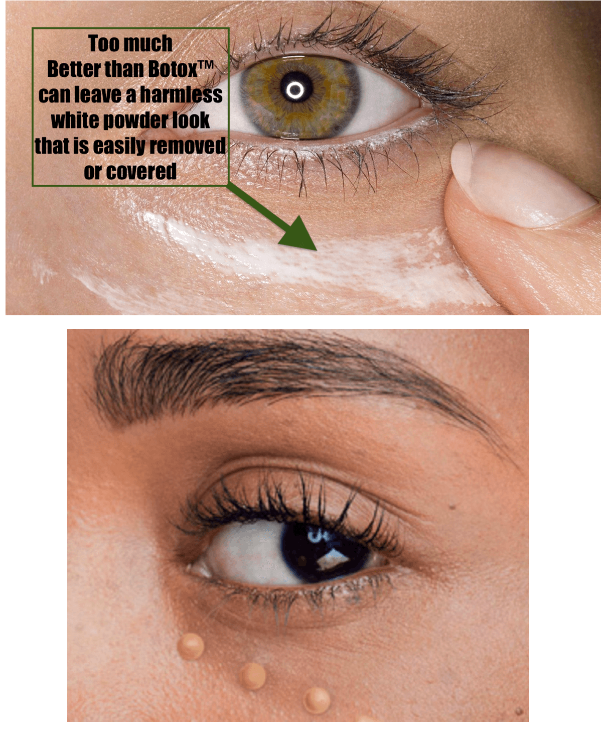 Better than Botox - Overt Beauty Bar