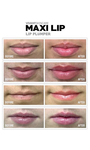Maxilip Lip Plumper - Overt Beauty Bar
