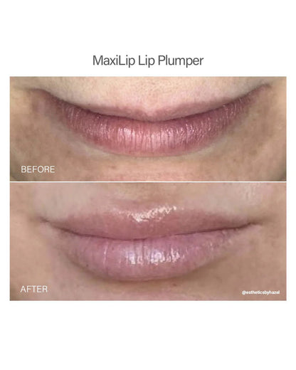 Maxilip Lip Plumper - Overt Beauty Bar