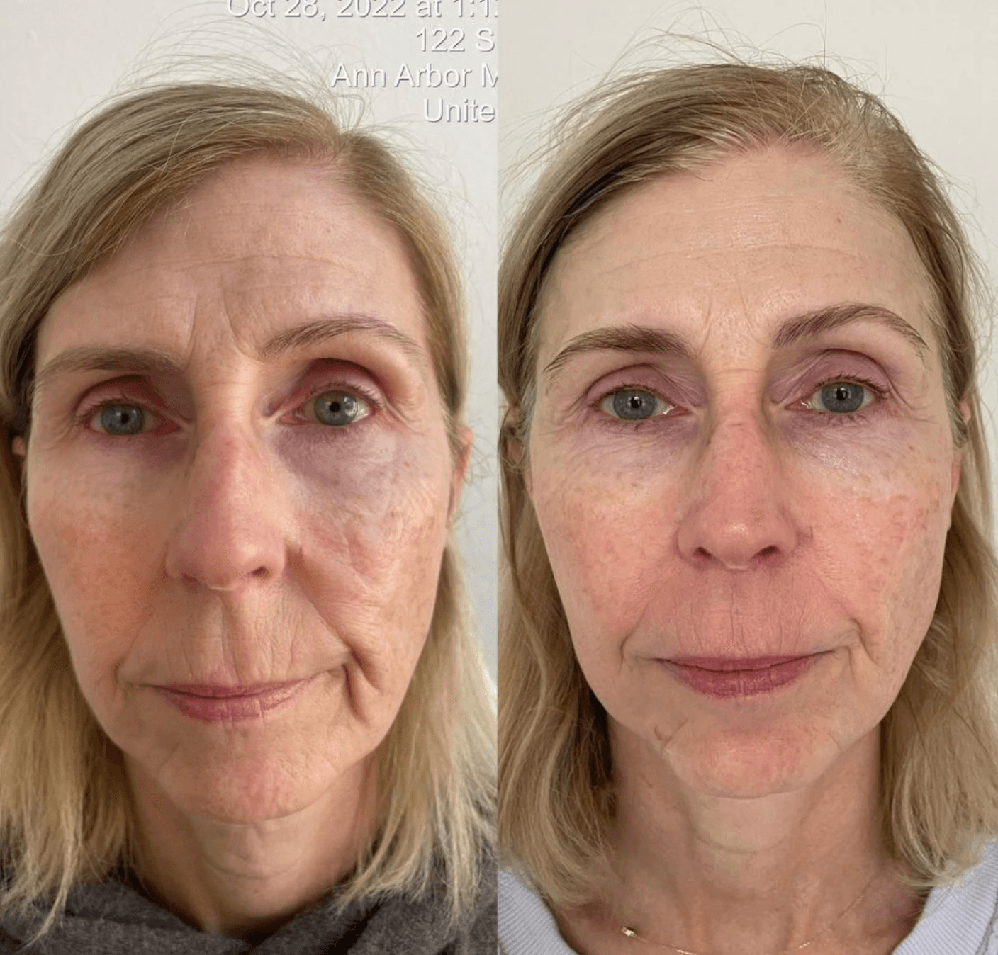 Youthplex Face Lift Serum - Overt Beauty Bar