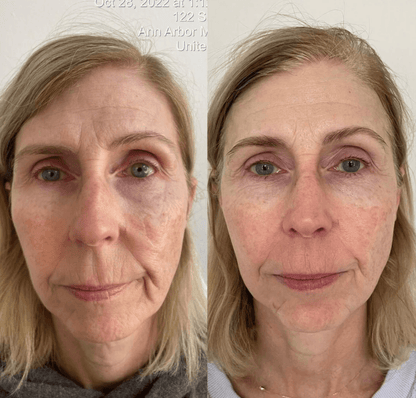 Youthplex Face Lift Serum - Overt Beauty Bar